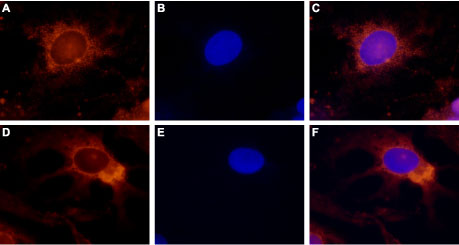 Anti-TRPV4 Antibody