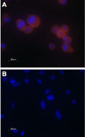 Anti-TRPV5 Antibody