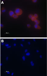 Anti-TRPV5 Antibody