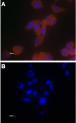 Anti-TRPV6 Antibody