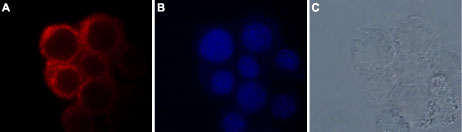Anti-TRPM7 Antibody
