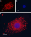 Anti-TRPP1 (PKD2) Antibody