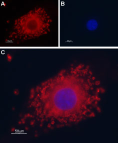 Anti-TRPP1 (PKD2) Antibody