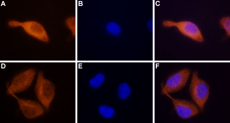 Anti-STIM2 Antibody