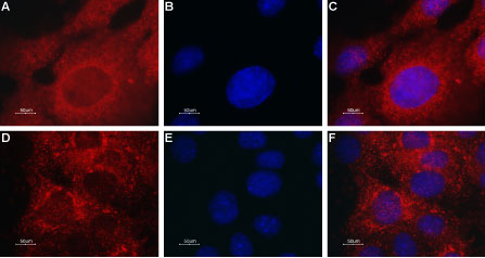 Anti-TRPML2 (Mucolipin-2) Antibody