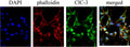 Anti-CLC-3 (CLCN3) Antibody