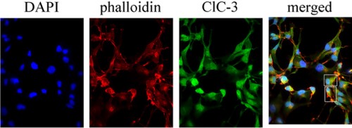 Anti-CLC-3 (CLCN3) Antibody