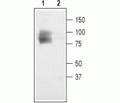 CLC-3/CLCN3 Blocking Peptide