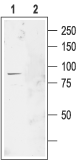 Anti-CLC-2 (CLCN2) Antibody