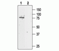 CLC-5 Blocking Peptide
