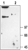 Anti-CLC-1 (CLCN1) Antibody