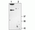 CLC-1/CLCN1 Blocking Peptide