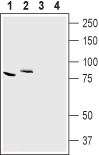 Anti-CLC-7 (CLCN7) Antibody