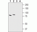 CLC-7/CLCN7 Blocking Peptide