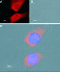 Anti-SERCA1 Antibody