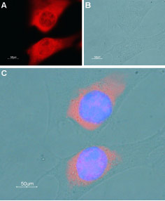 Anti-SERCA1 Antibody