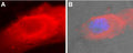 Anti-SERCA2 Antibody