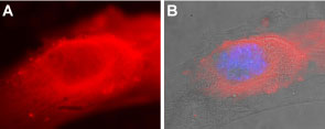 Anti-SERCA2 Antibody