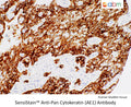SensiStain™ Anti-Pan Cytokeratin (AE1) Antibody – Figure 1 of 1