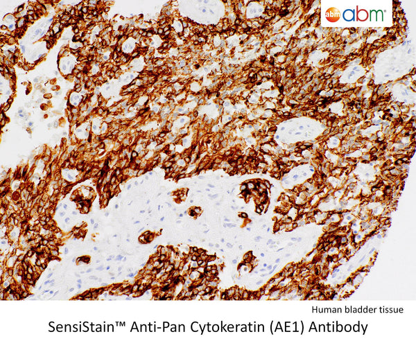 SensiStain™ Anti-Pan Cytokeratin (AE1) Antibody – Figure 1 of 1
