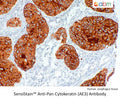 SensiStain™ Anti-Pan Cytokeratin (AE3) Antibody – Figure 1 of 1