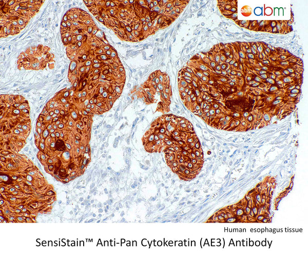 SensiStain™ Anti-Pan Cytokeratin (AE3) Antibody – Figure 1 of 1