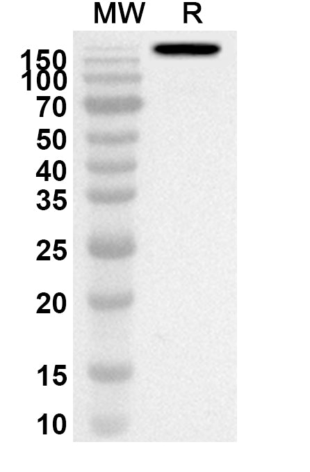 Western blot analysis was performed using anti-Golimumab polyclonal antibody at 1ug/mL on recombinant Golimumab (Catalog No. HF879046).