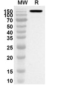 Western blot analysis was performed using anti-Etanercept polyclonal antibody at 1ug/mL on recombinant Etanercept (Catalog No. HF879296).
