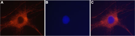 Anti-GRIK2 (GluK2) Antibody