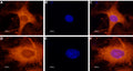 Anti-GALR1 Antibody