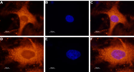 Anti-GALR1 Antibody