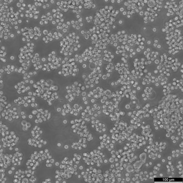 AKATA cell