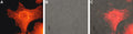 Anti-MC1 Receptor Antibody