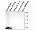 NGF Blocking Peptide