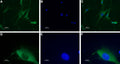 Anti-NPY1R Antibody