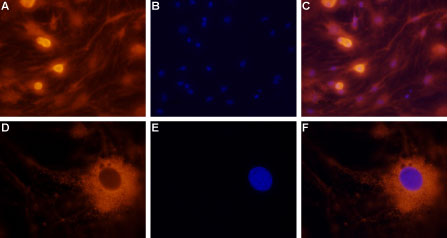 Anti-NPY2R Antibody