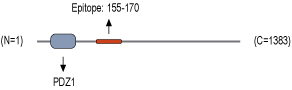 Anti-Periaxin Antibody