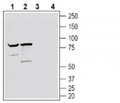 Neuronal Pentraxin Receptor (NPTXR) (extracellular) Blocking Peptide