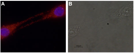 Anti-GDNF Antibody