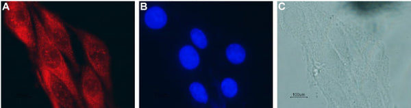 Anti-CNTF Antibody