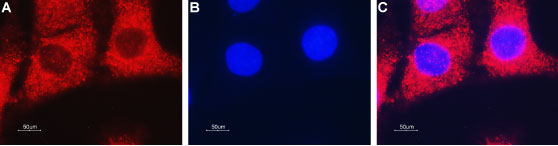 Anti-ENT2 (SLC29A2) Antibody