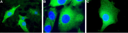 Anti-UCP2 Antibody