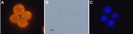 Anti-Orexin Receptor 1 Antibody
