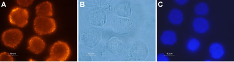 Anti-Orexin Receptor 2 Antibody
