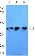 Western blot (WB) analysis of Sox2 polyclonal antibody at 1:500 dilution
Lane1:HEK293T whole cell lysate
Lane2:Raw264.7 whole cell lysate
Lane3:PC12 whole cell lysate