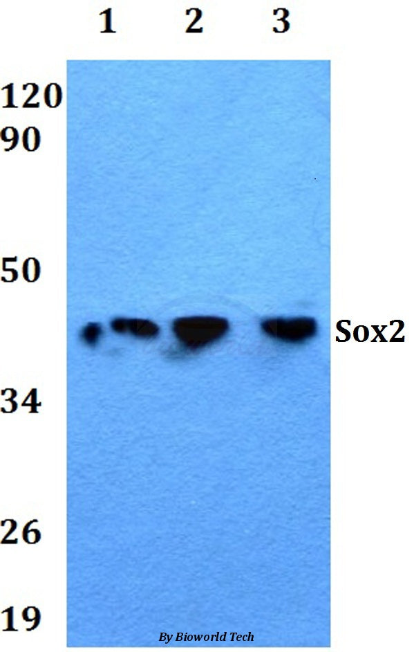 Western blot (WB) analysis of Sox2 polyclonal antibody at 1:500 dilution
Lane1:HEK293T whole cell lysate
Lane2:Raw264.7 whole cell lysate
Lane3:PC12 whole cell lysate