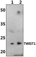 Western blot (WB) analysis of TWIST1 (M1) polyclonal antibody at 1:500 dilution
Lane1:Jurkat whole cell lysate(40ug)
Lane2:RAW264.7 whole cell lysate(40ug)