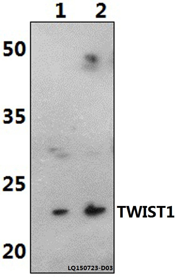 Western blot (WB) analysis of TWIST1 (M1) polyclonal antibody at 1:500 dilution
Lane1:Jurkat whole cell lysate(40ug)
Lane2:RAW264.7 whole cell lysate(40ug)