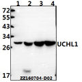 Western blot (WB) analysis of UCHL1 polyclonal antibody at 1:500 dilution
Lane1:HEK293T whole cell lysate(40ug)
Lane2:U251MG whole cell lysate(40ug)
Lane3:The brain tissue lysate of Mouse(40ug)
Lane4:The brain tissue lysate of Rat(40ug)