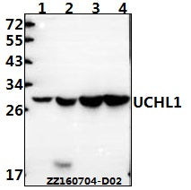 Western blot (WB) analysis of UCHL1 polyclonal antibody at 1:500 dilution
Lane1:HEK293T whole cell lysate(40ug)
Lane2:U251MG whole cell lysate(40ug)
Lane3:The brain tissue lysate of Mouse(40ug)
Lane4:The brain tissue lysate of Rat(40ug)